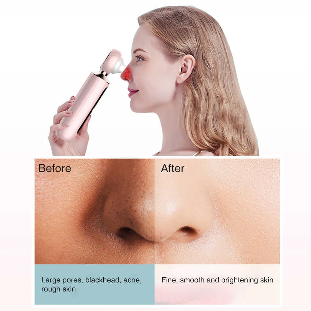 Norélla™ Blackhead Suction Machine