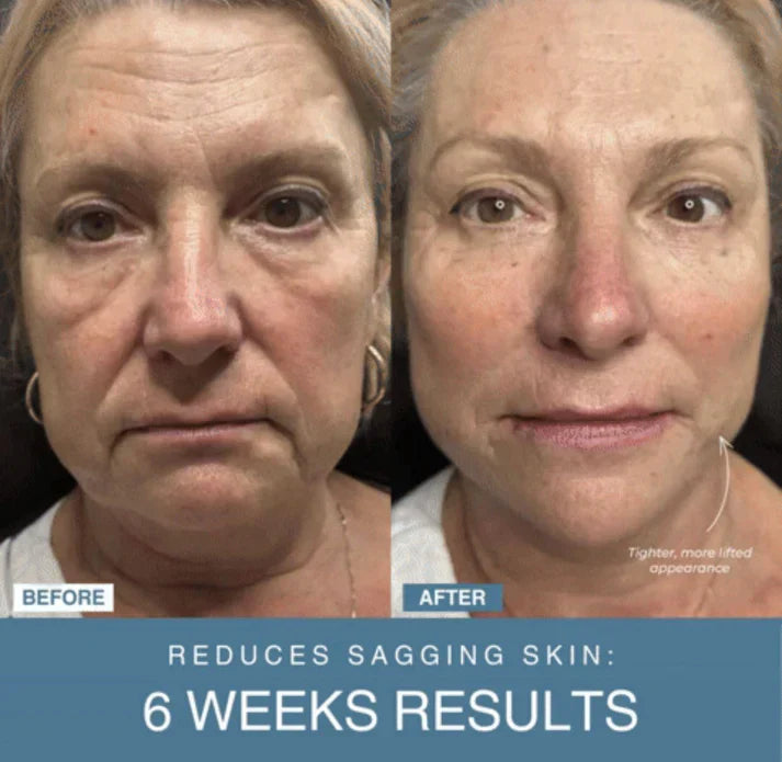 Norélla™ 7-in-1 LED Anti-Aging/Wrinkle Apparatus