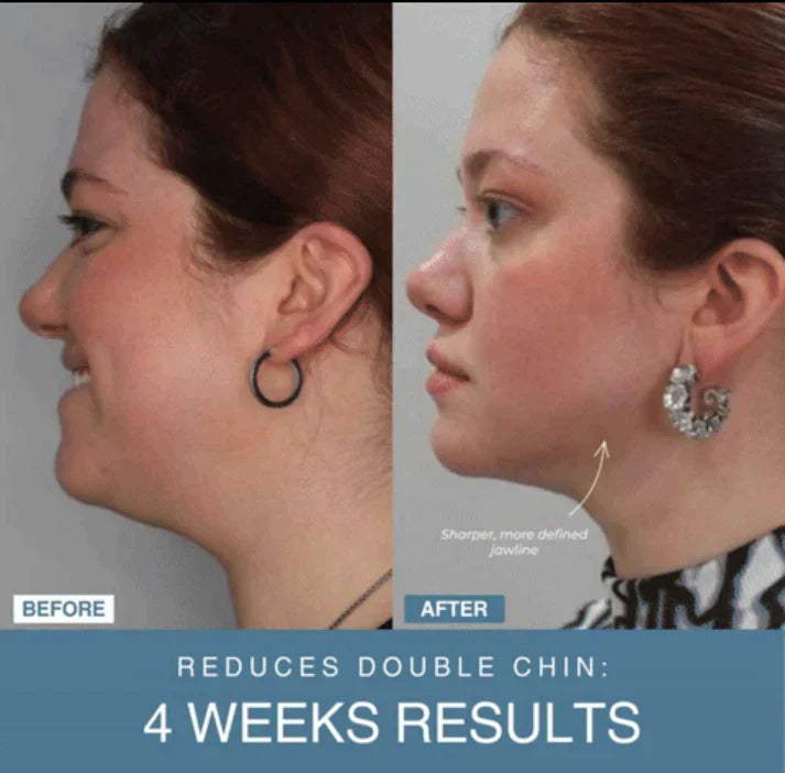 Norélla™ 7-in-1 LED Anti-Aging/Wrinkle Apparatus