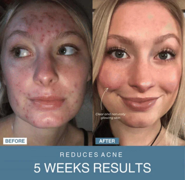 Norélla™ 7-in-1 LED Anti-Aging/Wrinkle Apparatus