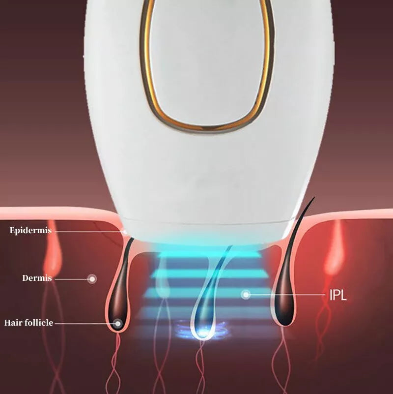 Norélla™ IPL Laser Hair Removal – جهاز إزالة الشعر بالليزر IPL